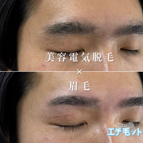 眉毛っち 大人気2wayマッシュを徹底解説 . . #横顔#スタイリング動画#韓流