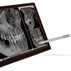 製品のご案内 | AXION JAPAN | LINE Official Account